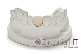 Zirconia High Translucent - All Ceramic Dental Crowns & Bridge