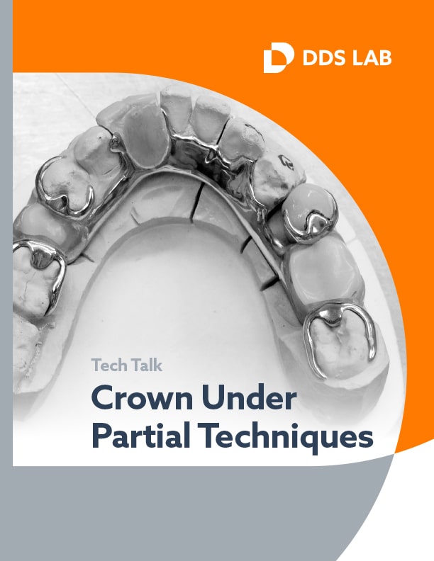 Crown Under Partial Techniques - TechTalk