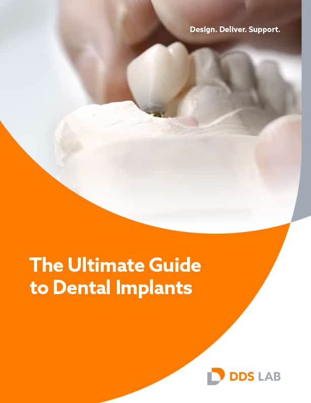 The Ultimate Guide to Dental Implants - DDS Lab TechTalk