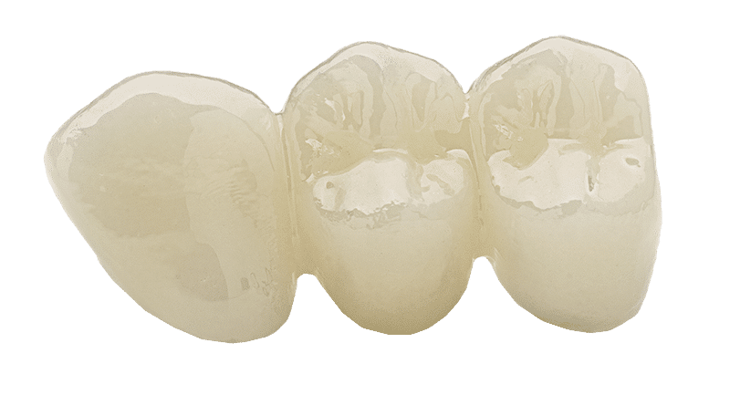 Dental Zirconia HT Bridge