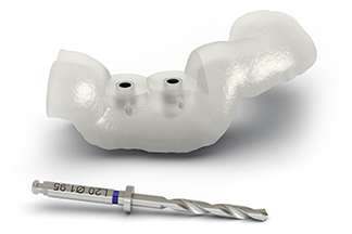 Dental Implants & Surgical Guides