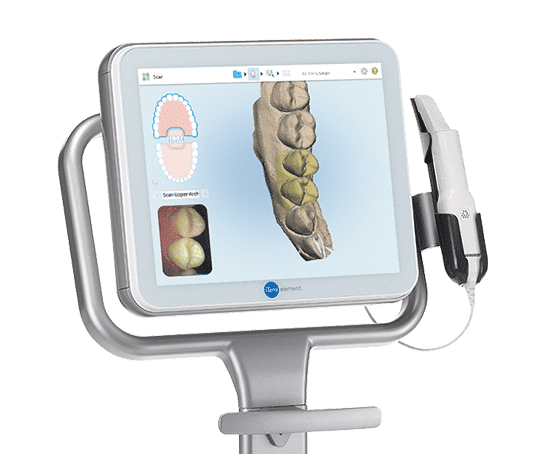 iTero Digital Impressions Scanner