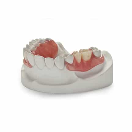DDS Lab's Dental Removable Products