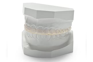 Dental Flat Bruxism Splint - DDS Lab's Orthodontic Products