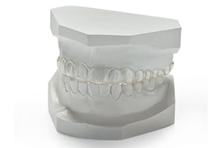 Dental Flexiguard Nightguard Splint - DDS Lab's Orthodontic Products