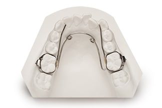 Fixed Expansion Bi Helix - DDS Lab's Orthodontic Products
