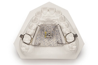 Dental Fixed Expansion Haas Palatal Expander - DDS Lab's Orthodontic Products