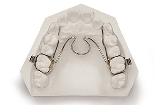 Dental Fixed Expansion W Arch Porter Appliance - DDS Lab's Orthodontic Products