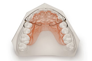 Dental Hawley Retainer with Soldered C Clasps - DDS Lab's Orthodontic Products