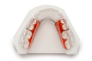 Dental Lower Mora Gelb Splint - DDS Lab's Orthodontic Products