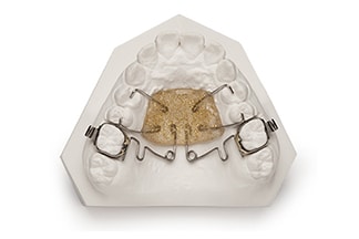 Dental Molar Distalizing Standard Pendulum - DDS Lab's Orthodontic Products