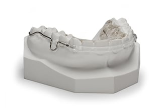 Dental QCM Wraparound Retainer - DDS Lab's Orthodontic Products