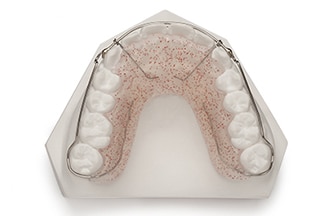Dental San Antonio Wraparound Retainer - DDS Lab's Orthodontic Products