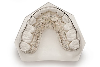 Dental Wraparound Retainer - DDS Lab's Orthodontic Products
