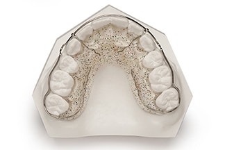 Orthodontics Lab - Wraparound Retainer