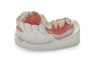 Dental Flexible Customflex Partial Denture - DDS Lab's Removable Products