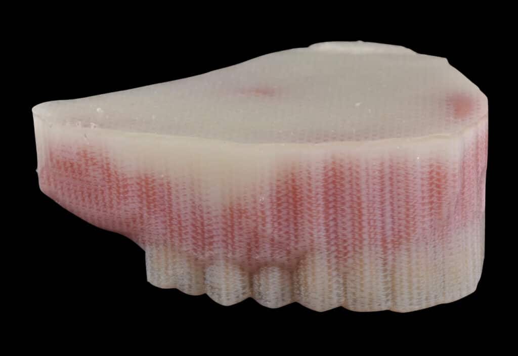3D Printed Digital Denture